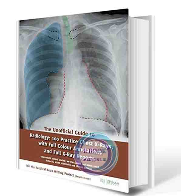 دانلود کتابThe Unofficial Guide to Radiology: 100 Practice Chest X Rays with Full Colour Annotations and Full X Ray Reports (Unoffical Guides) 1st  2017 (ORIGINAL PDF)
